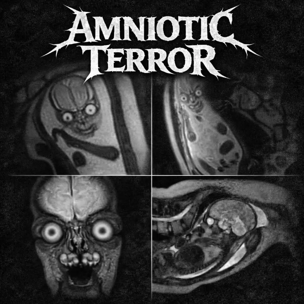 Amniotic Terror Band